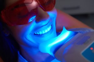 In Chair Professional Teeth Whitening